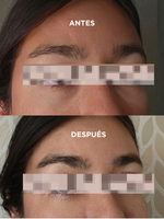 Power Shot Serum Contorno de Ojos - Thumbnail 2